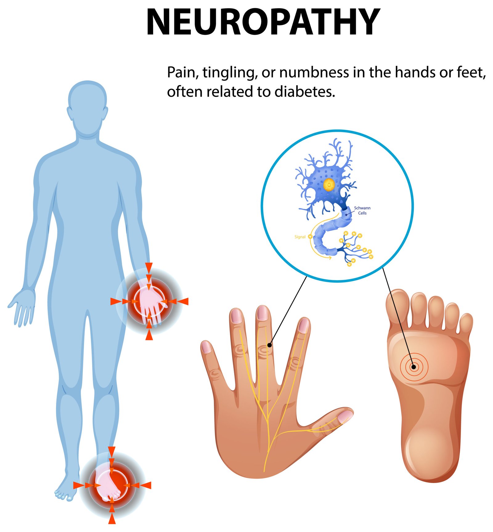 Neuropathy-scaled